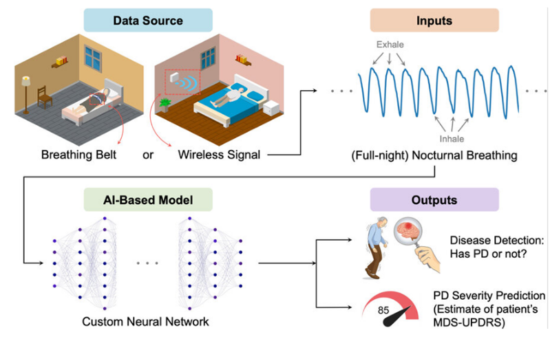Using artificial intelligence to detect Parkinson's disease by reading people's breathing patterns Using artificial intelligence to detect Parkinson's disease by reading people's breathing patterns
