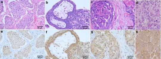 PAC-1, the first anti-cancer agent, has shown great promise in human cancer clinical trials PAC-1, the first anti-cancer agent, has shown great promise in human cancer clinical trials